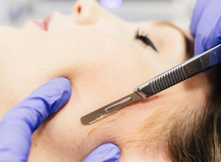 Dermaplaning-e1516663115816 Dermaplaning-e1516663115816
