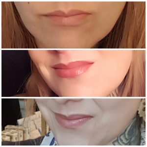 lips1 lips1