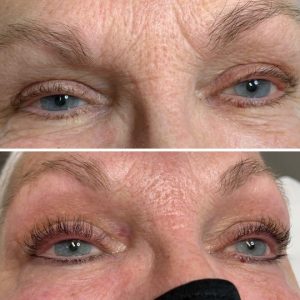eyelashes before and after